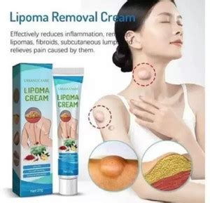URBANUCANBE Lipoma Removal Cream Lump Remover of Neck Fat, Shoulder Fat ...