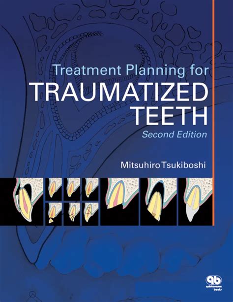 Mitsuhiro Tsukiboshi | Treatment Planning for Traumatized Teeth ...