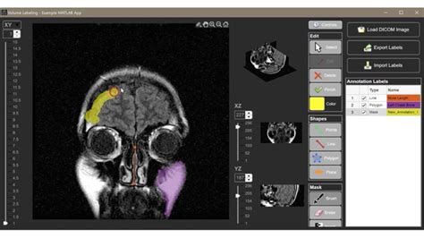 MATLAB Apps for Simulink Models Tutorial 的图像结果
