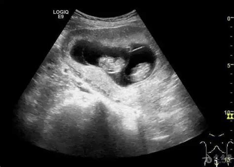 孕27周胎儿发育情况_27周的男胎儿的反应 - 随意云