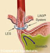 Image result for Linx System