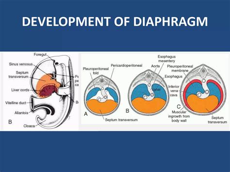 Diaphragmatic hernia | PPTX