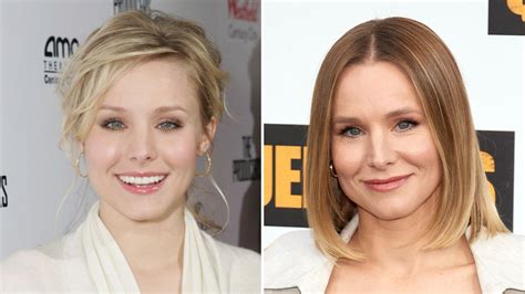 Did Kristen Bell Get Plastic Surgery? Her Transformation Photos | Life & Style