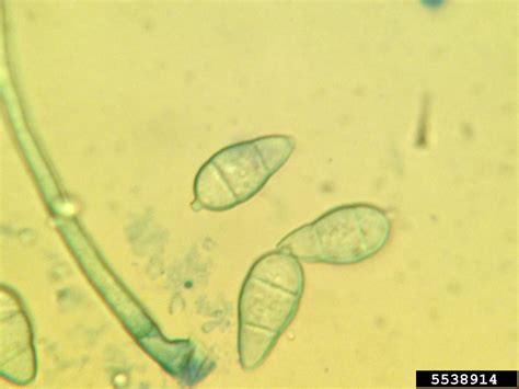 rice blast disease (Genus Pyricularia Sacc.)
