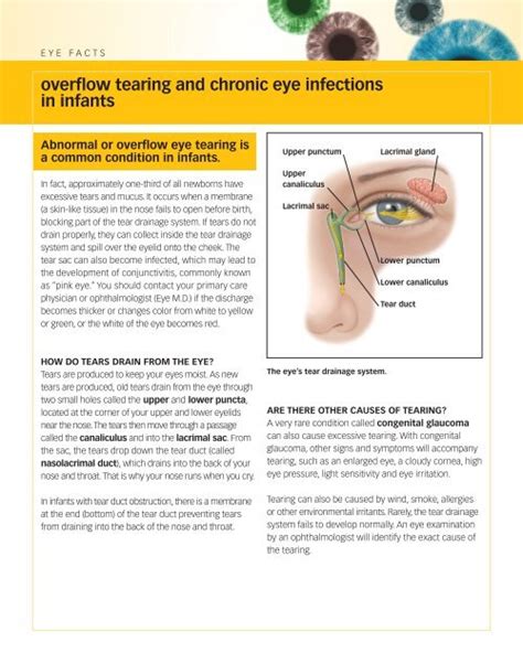 overflow tearing and chronic eye infections in infants - Oregon Eye ...