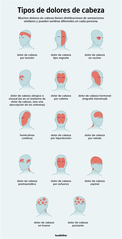 Tipos De Dolor De Cabeza