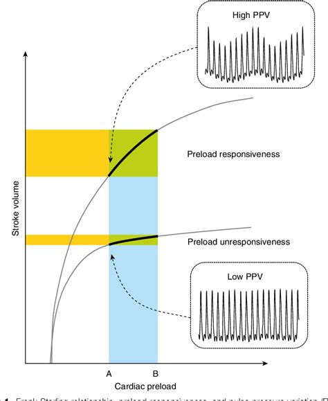 Image result for Pulse Pressure Variation EMCrit