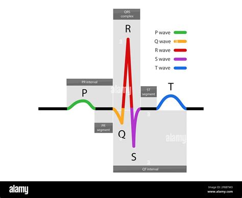 ecg waveform, Normal Atrial And Ventricular Depolarization With ...