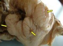 Veterinary Pathology