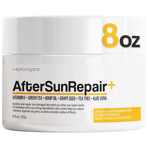 Amazon.com: Epic Organicum After Sun Lotion | Sunburn Relief | Aloe Vera & Vitamin E Cream ...