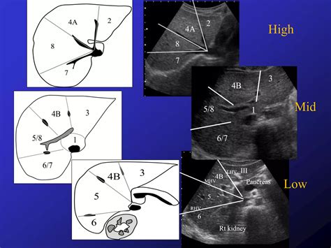 Liver segments on ultrasound | PPTX
