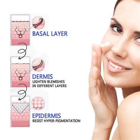 Buy Dark Spot Corrector, Dark Spot Remover - Improves Hyperpigmentation ...
