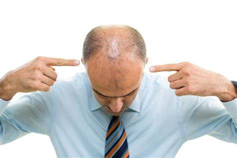 Hereditary Hair Loss Causes & Treatment Guide – Traya