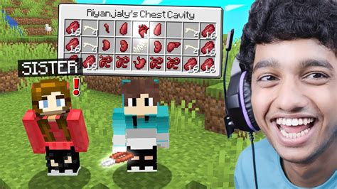 Image result for Minecraft Surgery Mod Gameplay