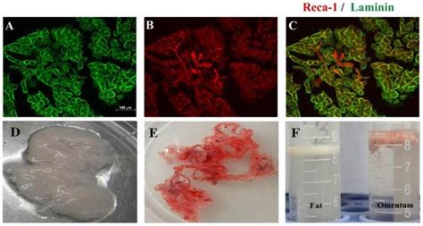 Traumatic Spinal Cord Injury | Encyclopedia MDPI