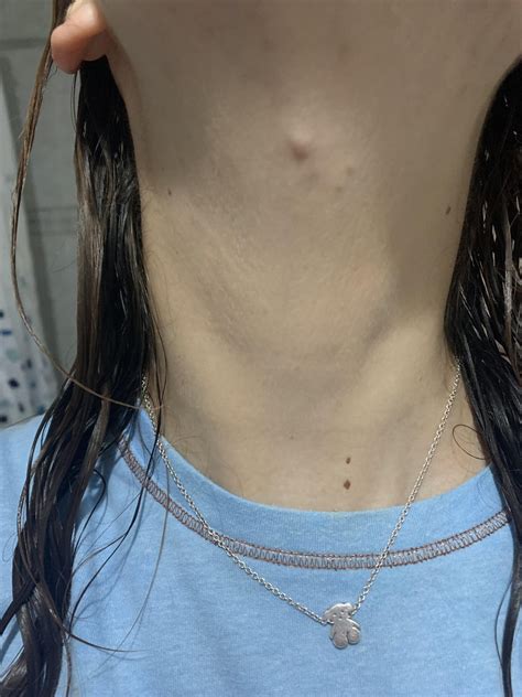 Lumps behind earlobe : r/AskDoctorSmeeee