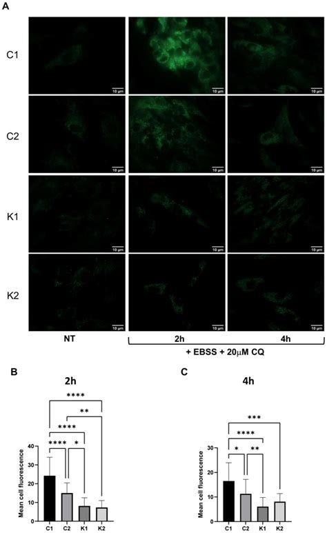 Impaired Autophagy in Krabbe Disease: The Role of BCL2 and Beclin-1 ...