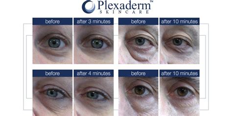 @ekaterinazajtseva1 — Teletype