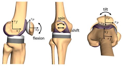 The Influence of Mathematical Definitions on Patellar Kinematics ...