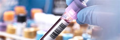 Enabling high quality testing for all clinical laboratories | Revvity