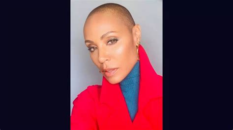 What is alopecia areata, the condition Jada Pinkett Smith suffers from ...