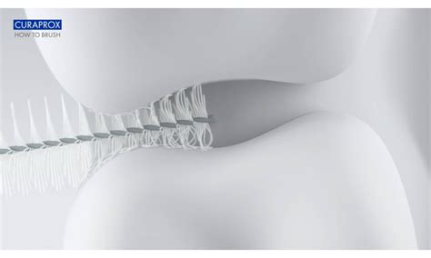 Mucositis: causes and treatment | CURAPROX