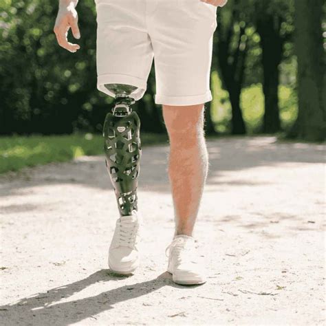 Prosthetic Service Pune| Artificial Limb Pune | Orthotics Pune