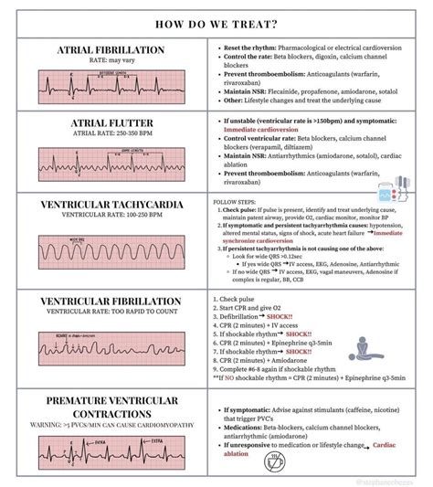 Ekg interpretation cheat sheet free download – Artofit