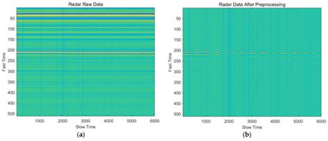 A Vital Signs Fast Detection and Extraction Method of UWB Impulse Radar ...