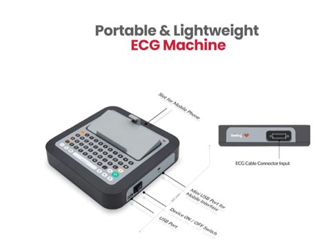 TRICOG VCARDIA 12-CHANNEL ECG MACHINE