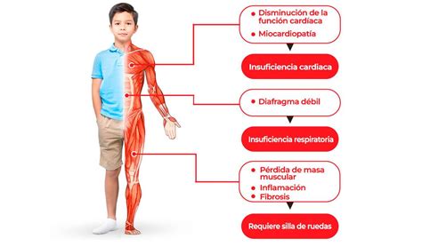 Día Mundial de la Distrofia Muscular de Duchenne: la clave está en ...