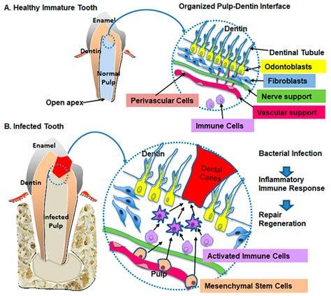Pulp–Dentin Tissue Healing Response: A Discussion of Current Biomedical ...