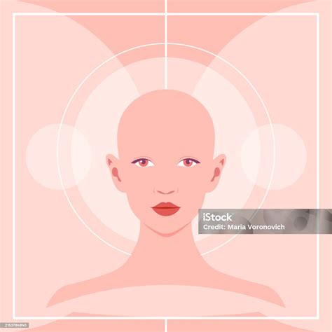 A Bald Young Woman Alopecia And Hair Loss Stock Illustration - Download ...