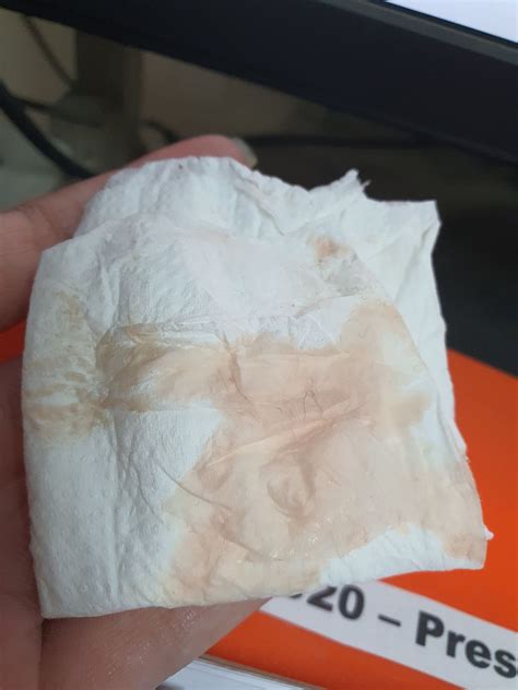 What Does Brown Implantation Bleeding Look Like On A Pad