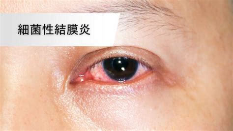 Image result for Identical Patterns Example