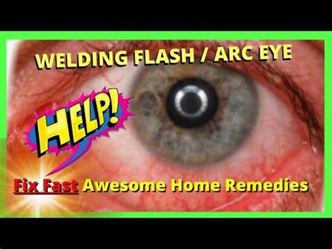 Image result for Weld Flash