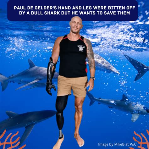 Bull shark bit off his right hand and leg and he now wants to save ...