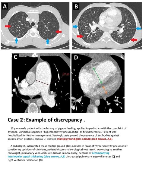 Image result for Discrepancy Examples