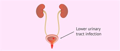 Neuronal circuitry of the lower urinary tract : central and peripheral neuronal control of the mictu