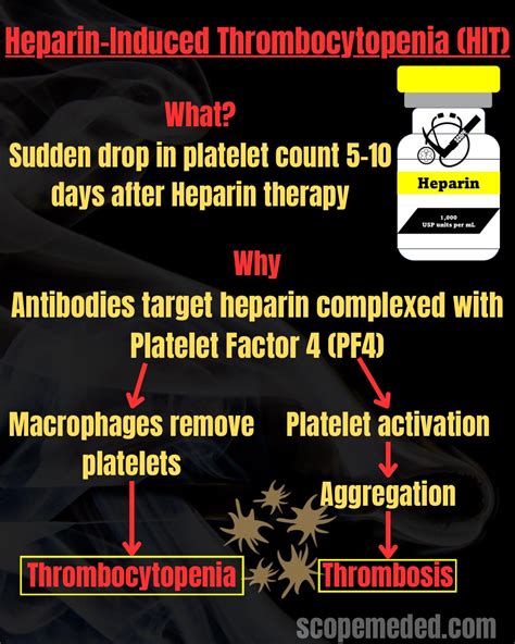What Is SQL Server Used for Hit 的图像结果