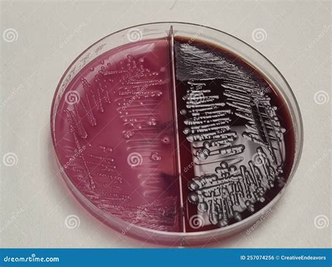 Macconkey Agar Plate