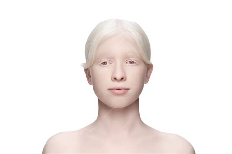 Beautiful Albino Black People