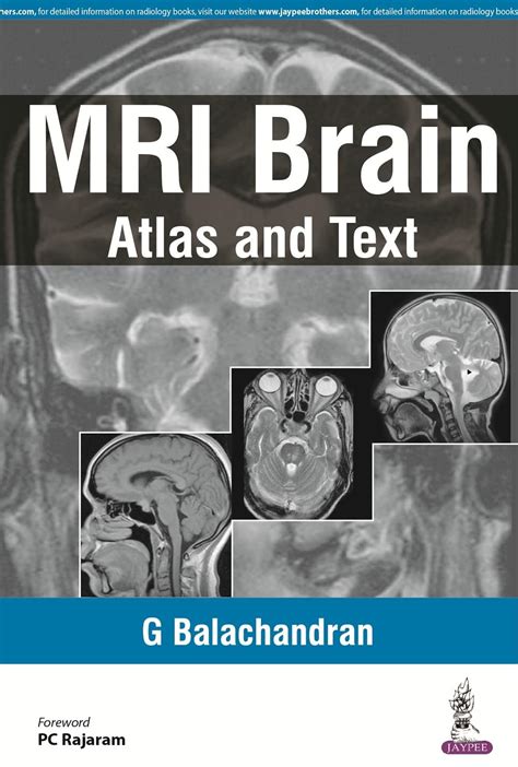 Buy MRI Brain: Atlas and Text (POD) Book Online at Low Prices in India ...