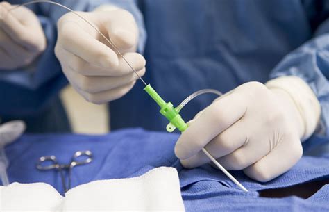 Coronary Angiography | JNU Hospital