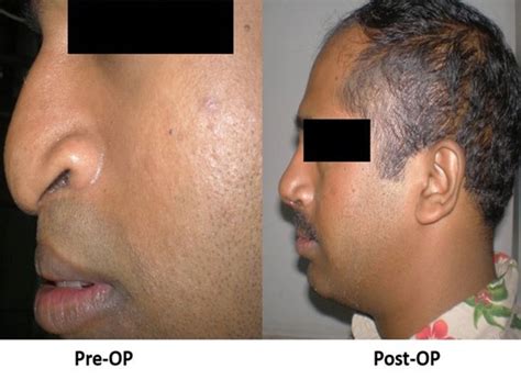 dental_operating_microscope