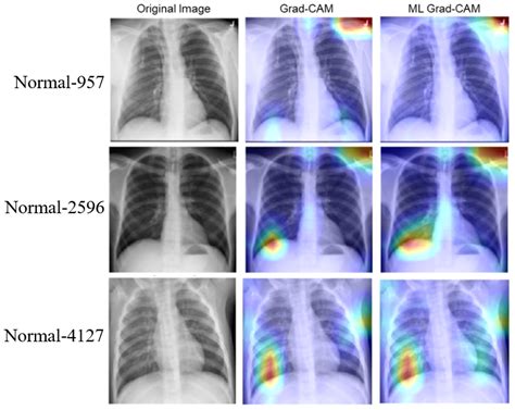 Machine-Learning-Enabled Diagnostics with Improved Visualization of ...