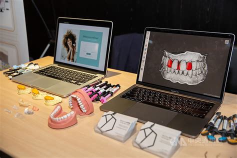 AI打造獨家樹脂資料庫 讓牙齒矯正更好看 | 科技 | 中央社 CNA
