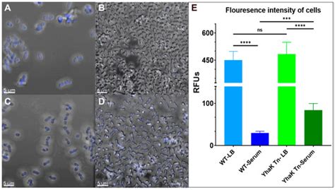 Antibiotics | Special Issue : Antibiotic Resistance in Acinetobacter ...