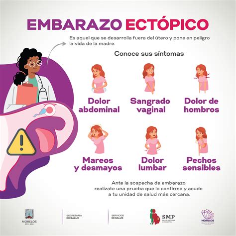 Embarazo Ectopico, 45% OFF | www.micoope.com.gt
