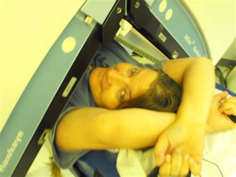 Image result for Muga Scan Lab Results